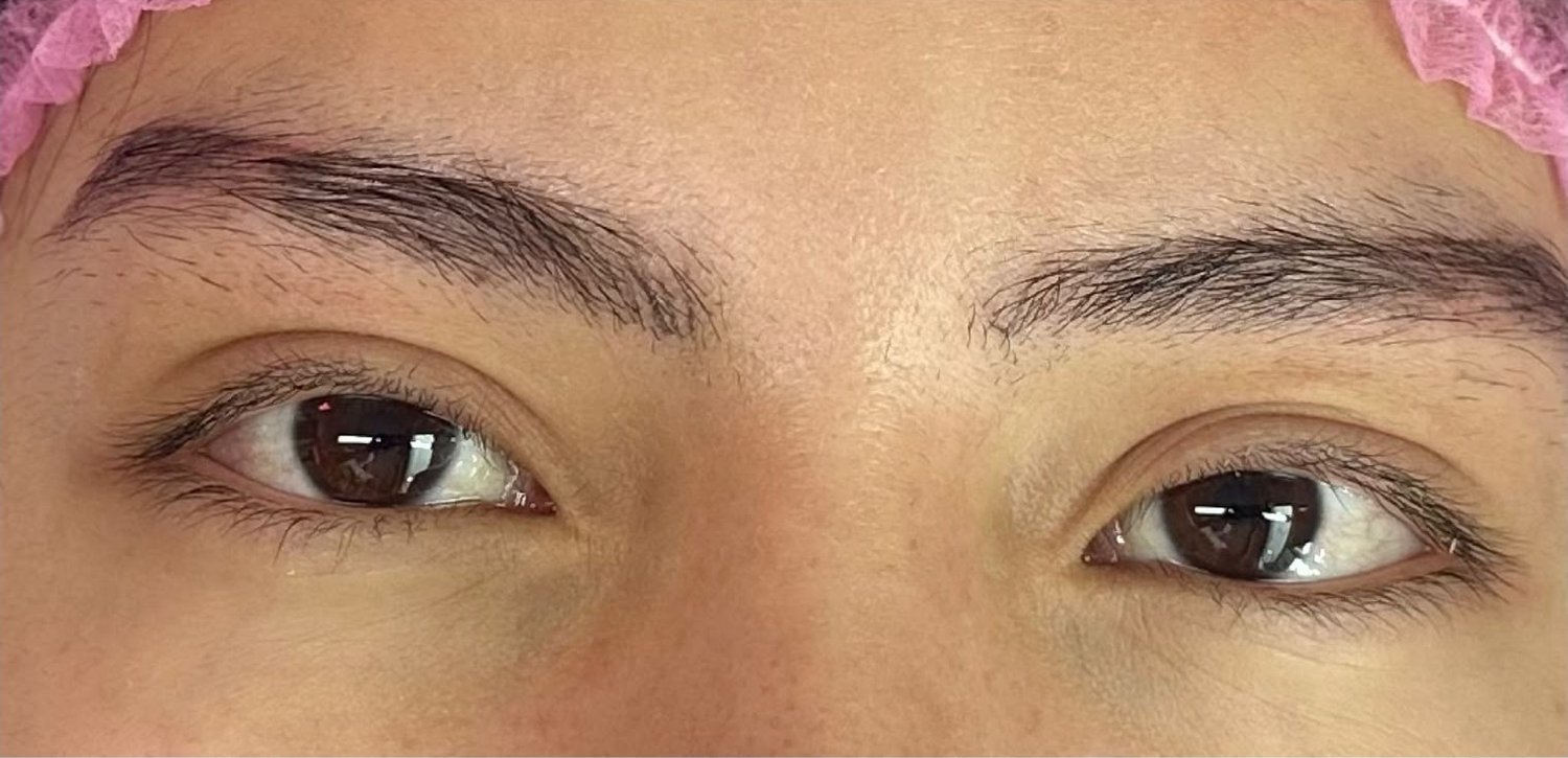 Antes