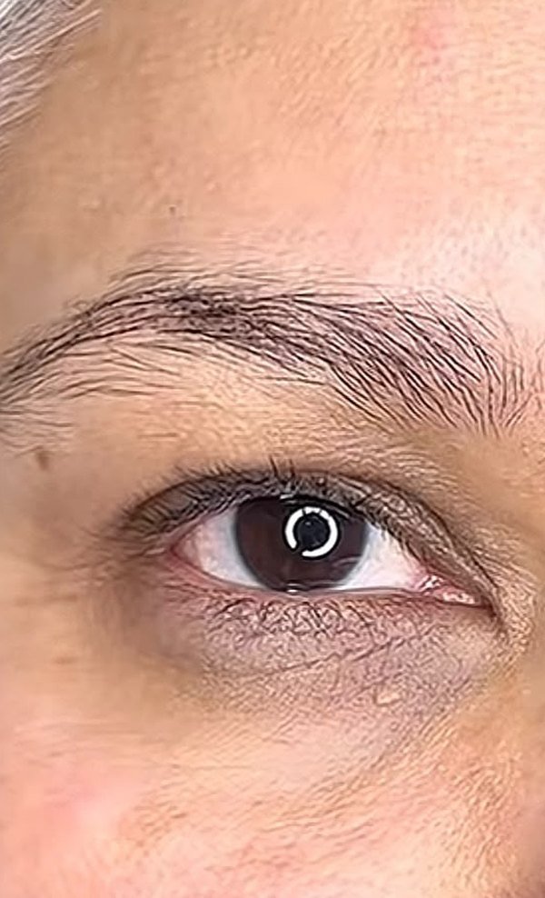 Antes